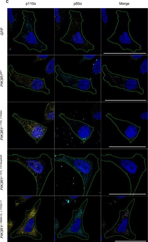 Fig.2.C showing Immunocytochemistry-immunofluorescence in a Homo sapiens (Human) sample from the publication: Somatic PIK3R1 mutations in the iSH2 domain are accessible to PI3Kα inhibition.