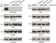 Fig.1.A showing Western Blotting in a Homo sapiens (Human) sample from the publication: Cortactin Is Required for Efficient FAK, Src and Abl Tyrosine Kinase Activation and Phosphorylation of Helicobacter pylori CagA.