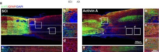 Fig.3.H showing Immunohistochemistry-immunofluorescence from the publication: Activin A enhances neurofunctional recovery following traumatic spinal cord injury by inhibiting autophagy.
