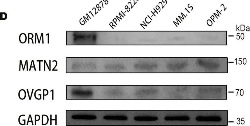 Fig.4.D showing Western Blotting in a Homo sapiens (Human) sample from the publication: Therapeutic Target Discovery for Multiple Myeloma: Identifying Druggable Genes via Mendelian Randomization.