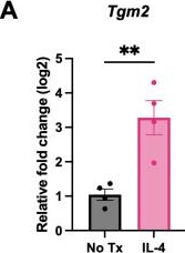 Fig.6.A from the publication: Transglutaminase 2 regulates ovarian cancer metastasis by modulating the immune microenvironment.