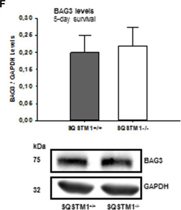 Sequestosome 1 Deficiency Delays, but Does Not Prevent Brain Damage Formation Following Acute Brain Injury in Adult Mice.