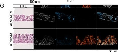 Fig.6.G showing Immunocytochemistry-immunofluorescence in a Homo sapiens (Human) sample from the publication: Interferon-γ selectively promotes survival of alveolar progenitor cells in a human lung organoid model.