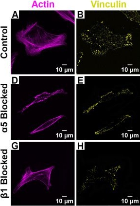Fig.7.A showing Immunocytochemistry-immunofluorescence from the publication: Effects of Topography and Extracellular Matrix Composition on Focal Adhesion Patterning in Human Corneal Fibroblasts.