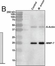 Fig.6.B showing Western Blotting from the publication: Responses of intestinal organoids to infection by Mycobacterium avium resemble symptoms observed in Crohn's disease.