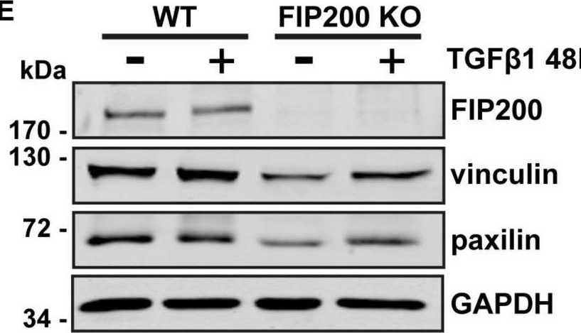 Fig.5.E showing Western Blotting in a Homo sapiens (Human) sample from the publication: Loss of the Essential Autophagy Regulators FIP200 or Atg5 Leads to Distinct Effects on Focal Adhesion Composition and Organization.