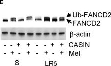 Fig.3.E showing Western Blotting in a Mus musculus (House mouse) sample from the publication: Rational Targeting of Cdc42 Overcomes Drug Resistance of Multiple Myeloma.