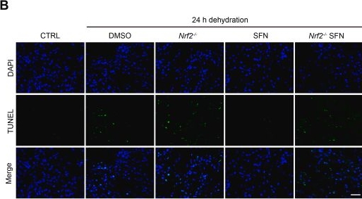 Fig.5.B showing Immunocytochemistry-immunofluorescence in a Mus musculus (House mouse) sample from the publication: Nrf2-mediated epigenetic priming of osmoprotective genes enhances cellular adaptation to hyperosmotic stress.