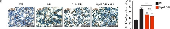 Fig.6.E showing Immunohistochemistry in a Homo sapiens (Human) sample from the publication: Endothelial Nitric Oxide Synthase-Dependent Mechanism of Hydroxyurea-Induced S-Phase Arrest in Erythroid Cells.