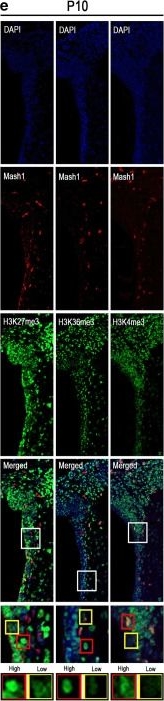 Fig.2.E showing Immunohistochemistry-immunofluorescence in a Mus musculus (House mouse) sample from the publication: Histone Methylations Define Neural Stem/Progenitor Cell Subtypes in the Mouse Subventricular Zone.