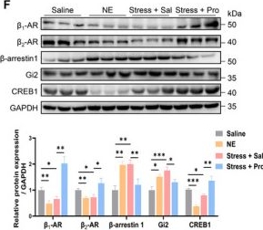 Fig.6.F showing Western Blotting from the publication: Norepinephrine Induces Sertoli Cell Ferroptosis via Receptors Desensitization Causing Stress-Related Male Reproductive Dysfunction.