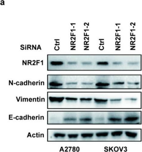 Fig.5.A showing Western Blotting in a Homo sapiens (Human) sample from the publication: NR2F1 Regulates TGF-β1-Mediated Epithelial-Mesenchymal Transition Affecting Platinum Sensitivity and Immune Response in Ovarian Cancer.