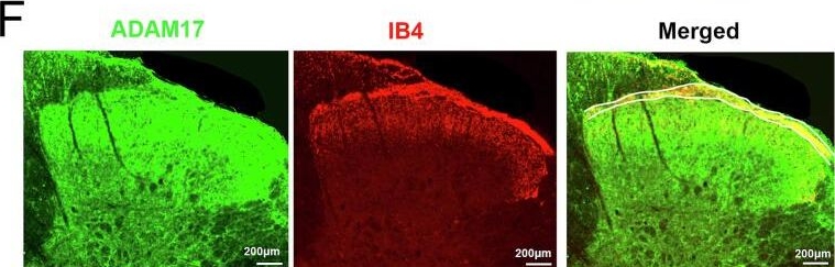 Fig.2.F showing Immunohistochemistry-immunofluorescence in a Rattus norvegicus (Rat) sample from the publication: Xpro®1595 alleviates neuropathic pain by targeting spinal dorsal horn ADAM17-mediated inflammation.