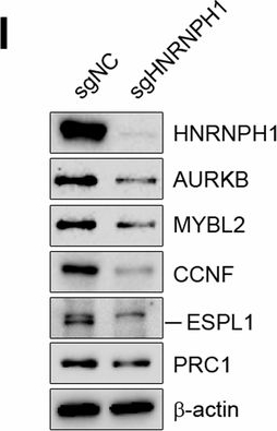 Fig.2.I showing Western Blotting in a Homo sapiens (Human) sample from the publication: HNRNPH1 drives glioblastoma progression by regulating the splicing of cell cycle genes.