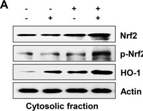Fig.6.A showing Western Blotting in a Homo sapiens (Human) sample from the publication: Anthocyanins Inhibits Oxidative Injury in Human Retinal Pigment Epithelial ARPE-19 Cells via Activating Heme Oxygenase-1.