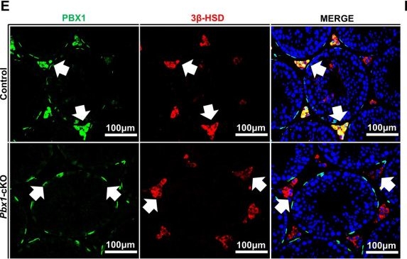 Fig.2.E showing Immunohistochemistry-immunofluorescence from the publication: Loss of PBX1 function in Leydig cells causes testicular dysgenesis and male sterility.