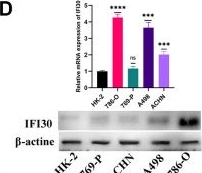 Fig.12.D showing Western Blotting from the publication: Identification and validation of a novel signature based on macrophage marker genes for predicting prognosis and drug response in kidney renal clear cell carcinoma by integrated analysis of single cell and bulk RNA sequencing.