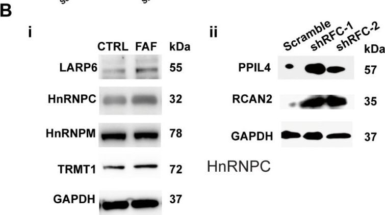 Fig.3.B showing Western Blotting in a Homo sapiens (Human) sample from the publication: Up-regulation of RNA Binding Proteins Contributes to Folate Deficiency-Induced Neural Crest Cells Dysfunction.