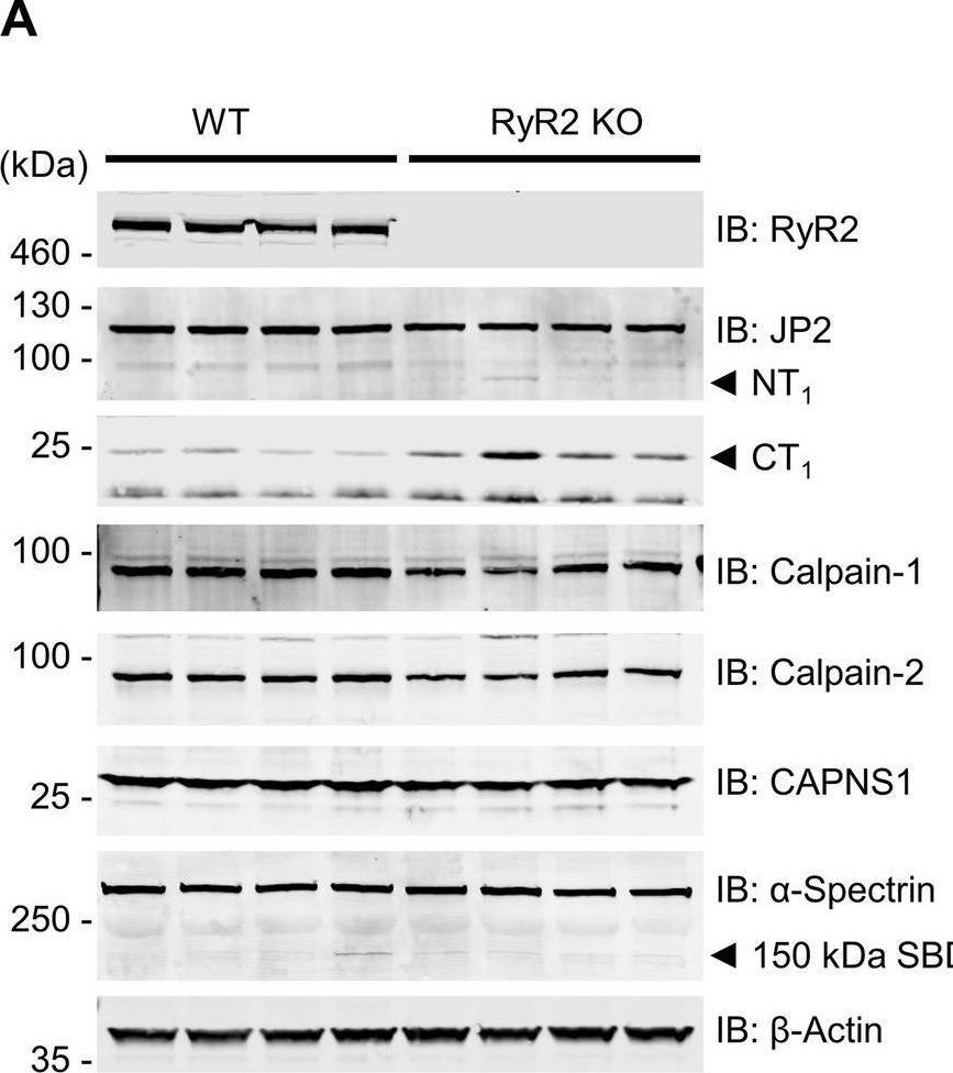 Fig.6.A showing Western Blotting in a Homo sapiens (Human) sample from the publication: Calpain cleavage of Junctophilin-2 generates a spectrum of calcium-dependent cleavage products and DNA-rich NT1-fragment domains in cardiomyocytes.