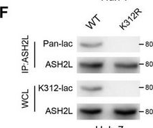 Fig.1.F showing Western Blotting in an Oryctolagus cuniculus (Rabbit) sample from the publication: ASH2L-K312-Lac Stimulates Angiogenesis in Tumors to Expedite the Malignant Progression of Hepatocellular Carcinoma.
