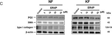 Fig.3.C showing Western Blotting in a Homo sapiens (Human) sample from the publication: Phosphoglucose isomerase directs the inflammatory response, calcium influx and fibroblast migration in keloids.