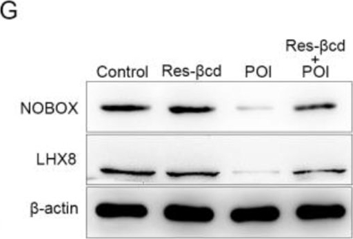 Fig.2.G showing Western Blotting from the publication: Resveratrol-βcd inhibited premature ovarian insufficiency progression by regulating granulosa cell autophagy.