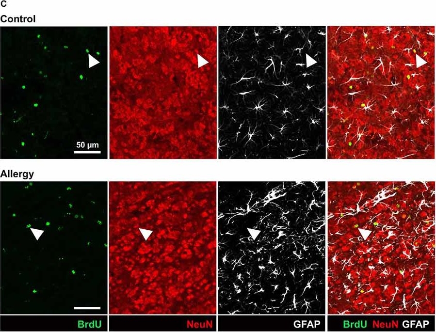 Allergy Enhances Neurogenesis and Modulates Microglial Activation in the Hippocampus.