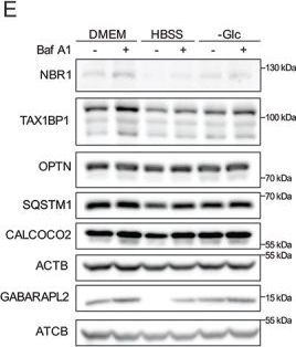 Fig.4.E showing Western Blotting from the publication: Targeted proteomics addresses selectivity and complexity of protein degradation by autophagy.