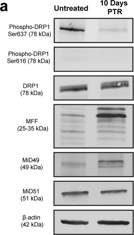 Fig.2.A showing Western Blotting from the publication: Cancer cells surviving cisplatin chemotherapy increase stress-induced OMA1 activity and mitochondrial fragmentation.