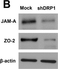 Fig.10.B showing Western Blotting from the publication: Fibrinogen in mice cerebral microvessels induces blood-brain barrier dysregulation with aging via a dynamin-related protein 1-dependent pathway.