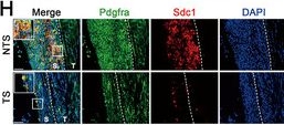 Fig.2.H showing Immunohistochemistry-immunofluorescence in a Mus musculus (House mouse) sample from the publication: Mechanical Strain-Programmed SDC1+ Sheath Fibroblasts Trigger CXCR4hi Neutrophil-Mediated Enthesitis in Ankylosing Spondylitis.