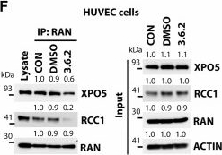 Fig.4.F showing Western Blotting from the publication: Allosteric inhibition of RAN decreases miR-126 biogenesis in endothelial cells and controls acute myeloid leukemia growth.