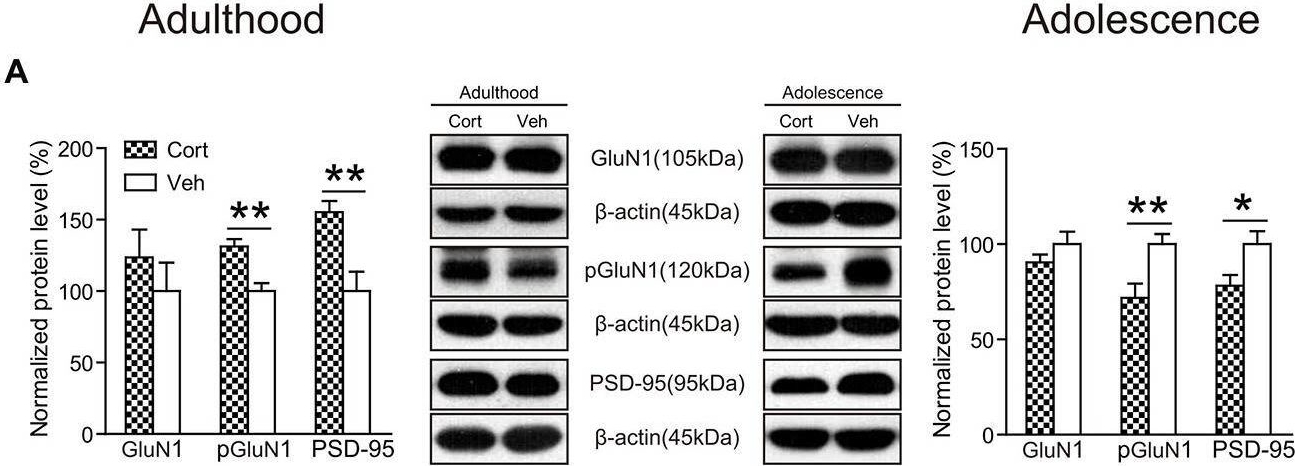 Fig.8.A showing Western Blotting in a Rattus norvegicus (Rat) sample from the publication: Differential Behavioral and Neurobiological Effects of Chronic Corticosterone Treatment in Adolescent and Adult Rats.