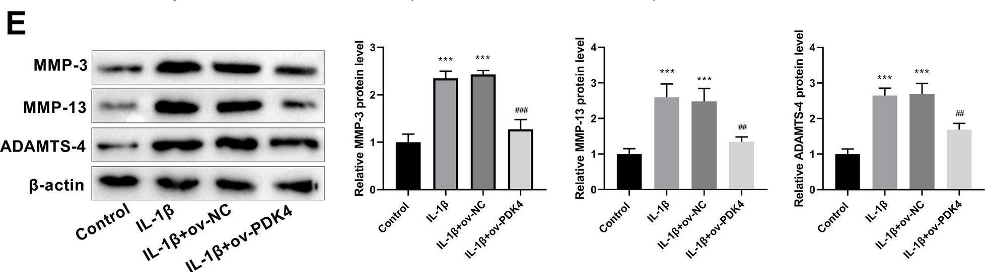 Fig.4.E showing Western Blotting from the publication: PDK4 inhibits osteoarthritis progression by activating the PPAR pathway.