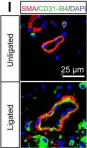 Fig.1.I showing Immunohistochemistry-immunofluorescence in a Mus musculus (House mouse) sample from the publication: Suppression of ischemia in arterial occlusive disease by JNK-promoted native collateral artery development.