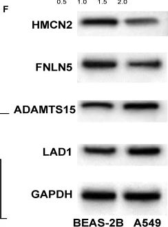 Fig.2.F showing Western Blotting in a Homo sapiens (Human) sample from the publication: Comprehensive analysis of the basement membrane in lung adenocarcinoma by bulk and single-cell sequencing analysis.