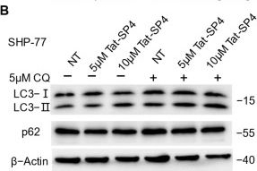 Fig.1.B showing Western Blotting in a Homo sapiens (Human) sample from the publication: Autophagy-Targeting Stapled Peptide Utilizes Macropinocytosis for Cell Entry to Potentiate Anti-Proliferative Autosis in Small-Cell Lung Cancer.