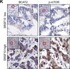 Fig.5.K showing Immunohistochemistry from the publication: Disrupting SRSF10-dependent BCAT2 exon skipping reprograms tumor-associated macrophages and enhances anti-PD-1 efficacy in gastric cancer.