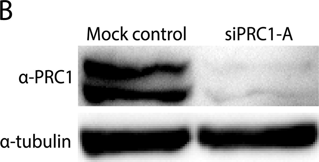 Fig.3.B showing Western Blotting in a Rattus norvegicus (Rat) sample from the publication: Draft De Novo Transcriptome of the Rat Kangaroo Potorous tridactylus as a Tool for Cell Biology.