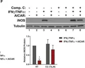 Fig.5.F showing Western Blotting in a Mus musculus (House mouse) sample from the publication: The AMPK agonist 5-aminoimidazole-4-carboxamide ribonucleotide (AICAR), but not metformin, prevents inflammation-associated cachectic muscle wasting.