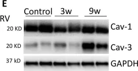 Fig.3.E showing Western Blotting from the publication: Modulation of caveolins, integrins and plasma membrane repair proteins in anthracycline-induced heart failure in rabbits.