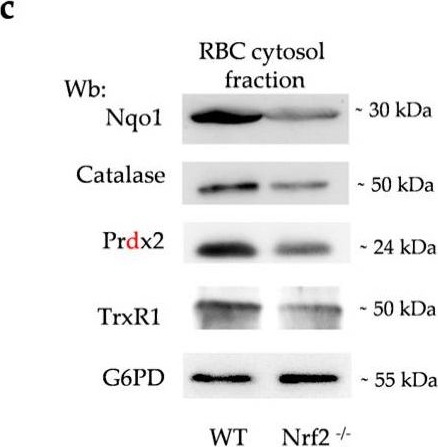 Fig.1.C showing Western Blotting in a Mus musculus (House mouse) sample from the publication: Nrf2 Plays a Key Role in Erythropoiesis during Aging.