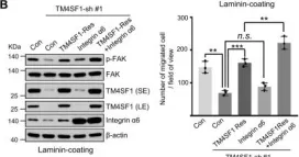 Fig.5.B showing Western Blotting from the publication: TM4SF1 promotes esophageal squamous cell carcinoma metastasis by interacting with integrin α6.