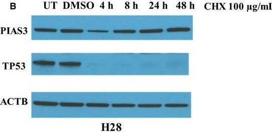 Fig.2.B showing Western Blotting in a Homo sapiens (Human) sample from the publication: Post-transcriptional regulation of PIAS3 expression by miR-18a in malignant mesothelioma.