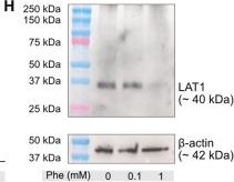 Fig.7.H showing Western Blotting in a Homo sapiens (Human) sample from the publication: L-Phenylalanine is a metabolic checkpoint of human Th2 cells.