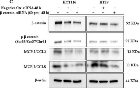 Fig.6.C showing Western Blotting from the publication: FH535-mediated inhibition of Wnt/β-catenin suppresses CRC growth and invasion and alters MCP1 and MCP2 expression with potential immunological implications.