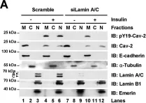 Fig.2.A showing Western Blotting in a Homo sapiens (Human) sample from the publication: Insulin-response epigenetic activation of Egr-1 and JunB genes at the nuclear periphery by A-type lamin-associated pY19-Caveolin-2 in the inner nuclear membrane.