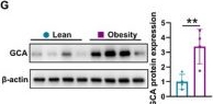 Fig.1.G showing Western Blotting in a Mus musculus (House mouse) sample from the publication: Gut Microbiota Modulates Obesity-Associated Skeletal Deterioration Through Macrophage Aging and Grancalcin Secretion.