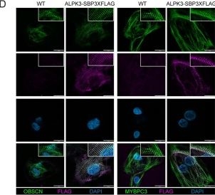 Fig.2.D showing Immunocytochemistry-immunofluorescence in a Mus musculus (House mouse) sample from the publication: Alpha kinase 3 signaling at the M-band maintains sarcomere integrity and proteostasis in striated muscle.