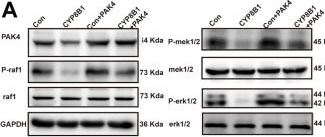 Fig.5.A showing Western Blotting from the publication: CYP8B1 inhibits hepatocellular carcinoma progression by repressing PAK4 transcription through inhibition of nuclear translocation of u-STAT1.